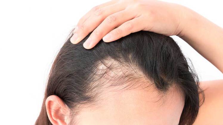 7 راه برای رشد مجدد موهای نازک
